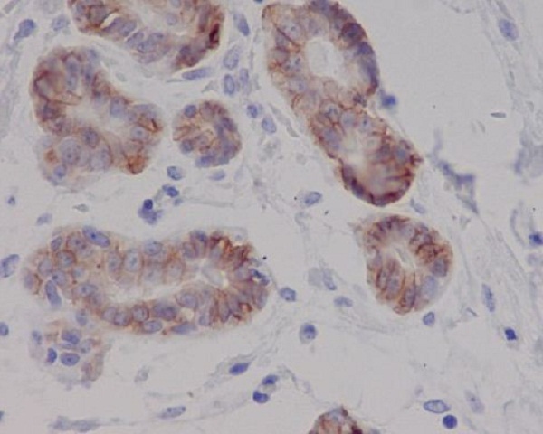 IHC - Anti-c-Kit Rabbit Monoclonal Antibody ABO13626